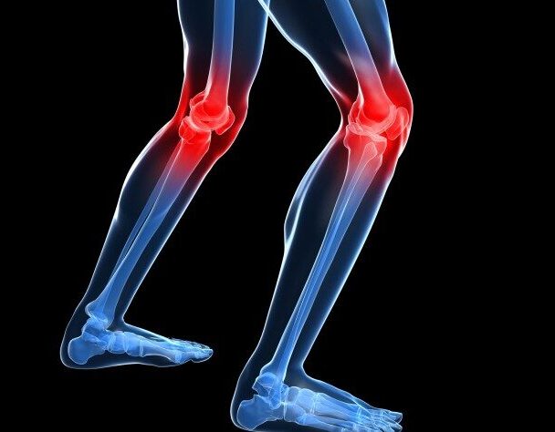 Lesiones frecuentes
¿CUÁLES SON?
Tendinitis: es la inflamación de las estructuras tendinosas, principalmente el tendón rotuliano y el tendón del cuádriceps. causa de dolor frecuente de la rodilla.
