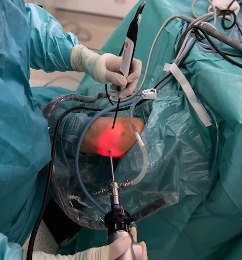 Tratamientos
Medicina física
Primera línea de tratamiento en los diversos problemas de la rodilla.

Cirugía artroscópica