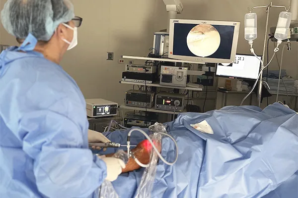 La rodilla
Es una articulación grande y compleja, formada por estructuras óseas como el fémur, la tibia y la rótula, estructuras ligamentarias y tendinosas que permiten soportar el peso y una adecuada función del miembro inferior.

Es susceptible de muchas lesiones, debido a su función compleja y a las exigencias diarias a las que es sometida.
